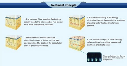 Treatment principle