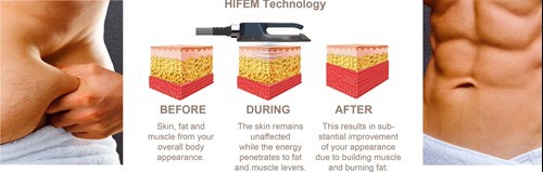 HIFEM technology