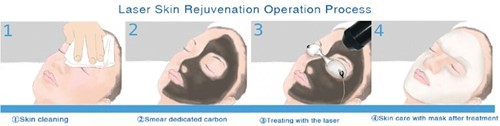 Carbon Facial treatment (black doll)