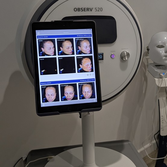 Used observ