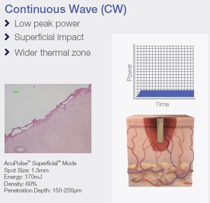 Continuous Wave